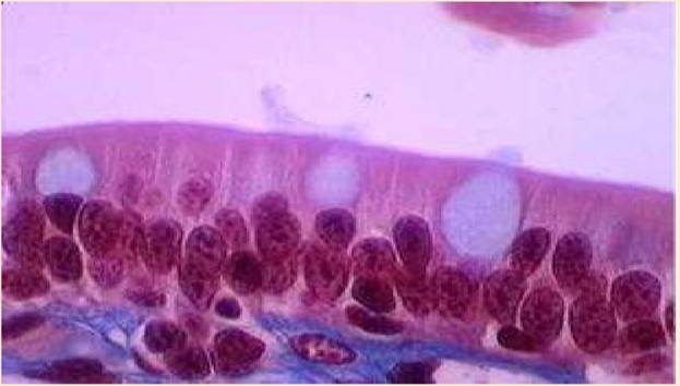 Epitélio Pseudo-Estratificado.